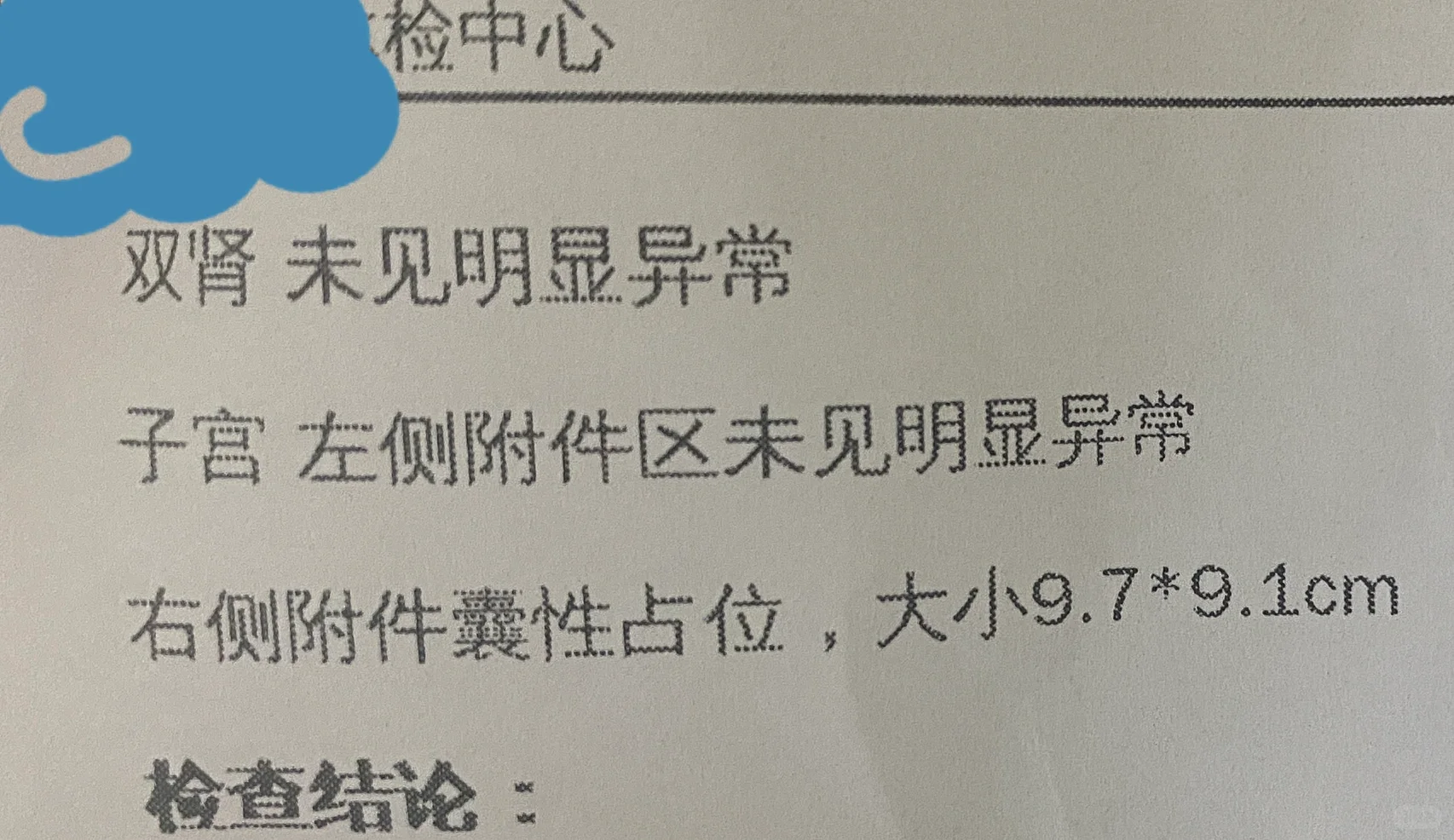 30岁卵巢囊肿腹腔镜手术记录1