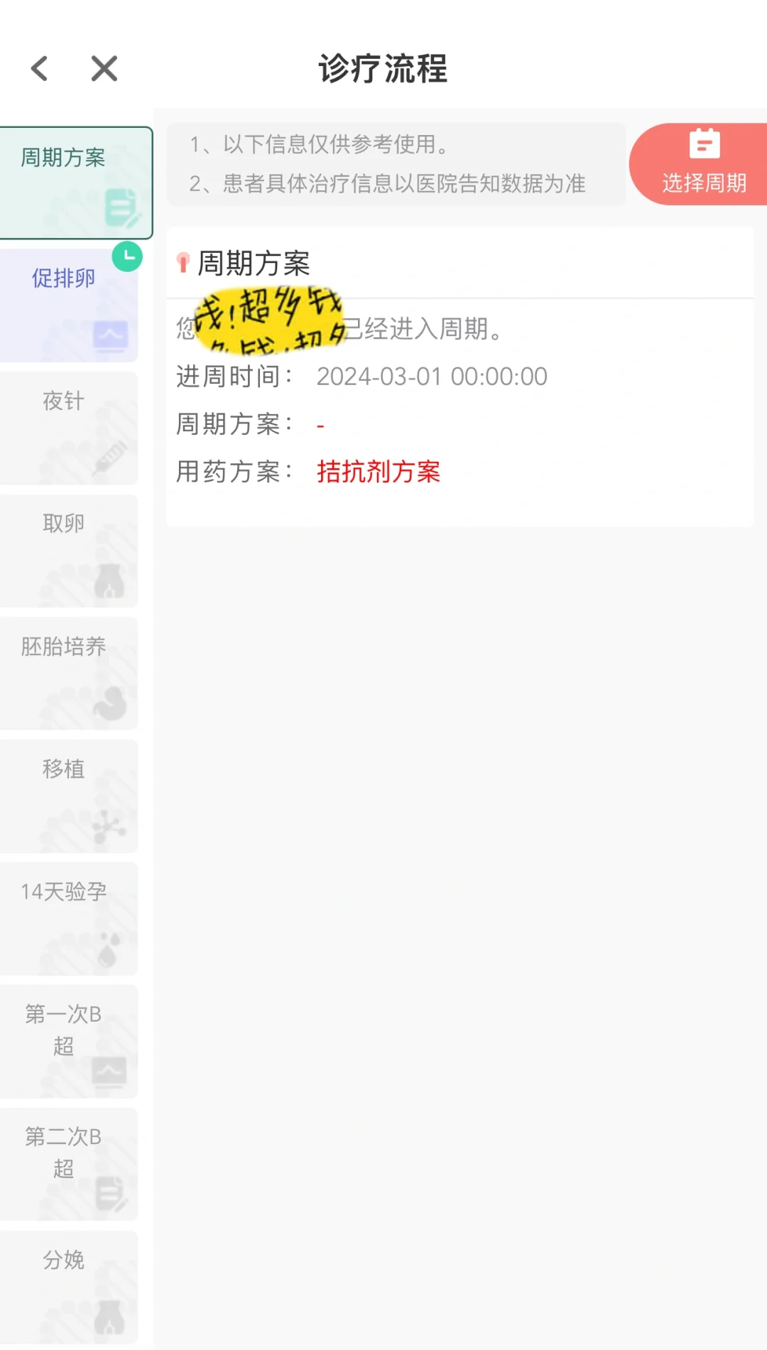 三代试管拮抗剂方案，促排阶段