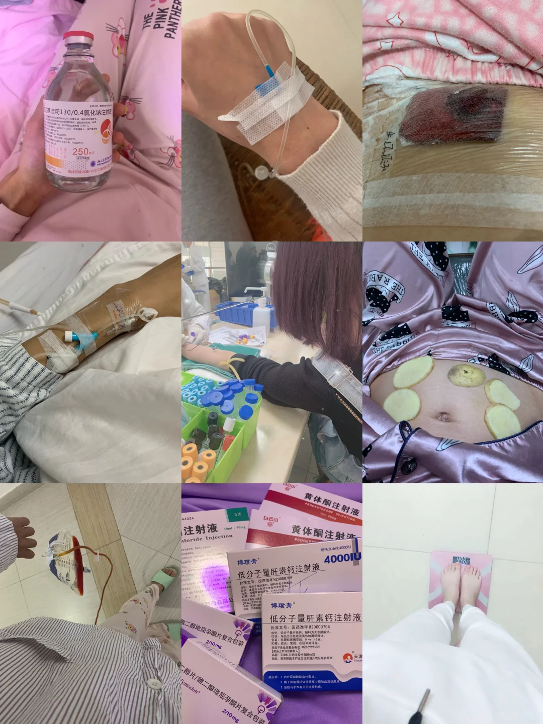 我的试管之路