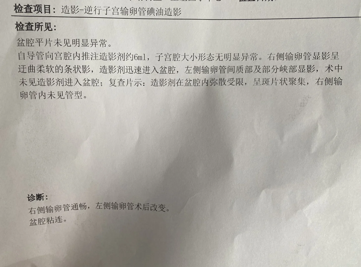 输卵管造影