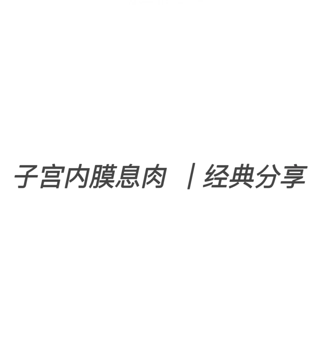 子宫内膜息肉的那些事