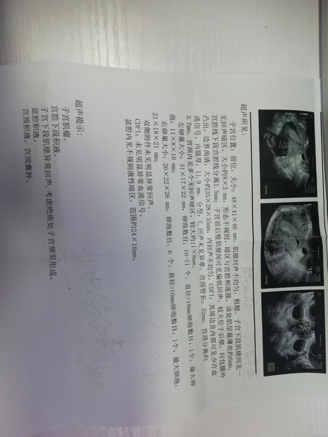 订了4.23自然周期移植